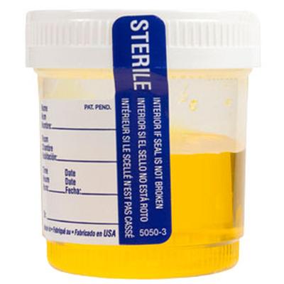 Click to get Urine Sample Candy